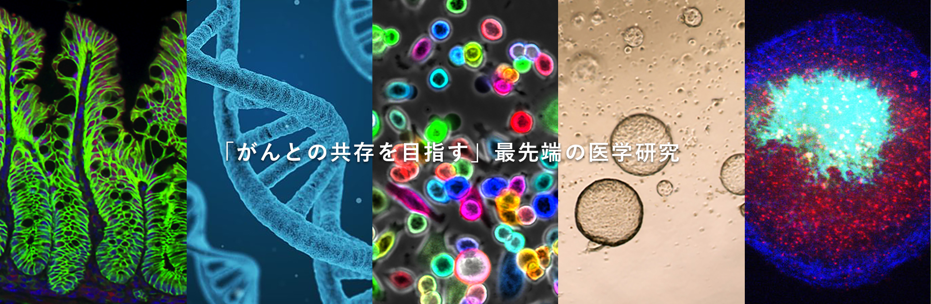 「がんとの共存を目指す」最先端の医学研究